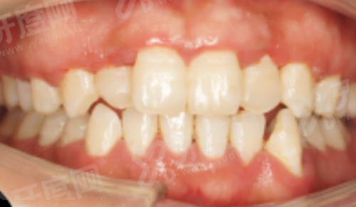 九江中山口腔医院是公立还是私立？属正规私立连锁，数字化种植矫正技术强收费透明