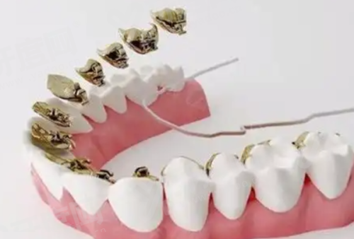 沈阳德立联合口腔医院种植牙靠谱吗？靠谱！数字化微创技术成熟，正规连锁口碑赞值得选