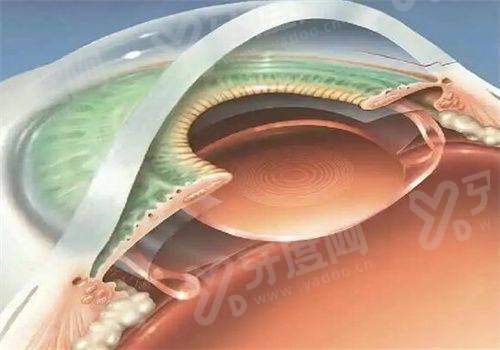 二、商丘普明眼科的医生团队擅长哪些领域？yanke.yadoo.cn