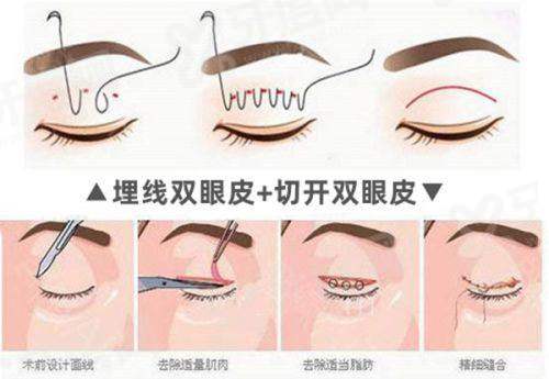 杭州格莱美医疗美容医院医生介绍：面部抗衰技术优势显著效果自然更安心；