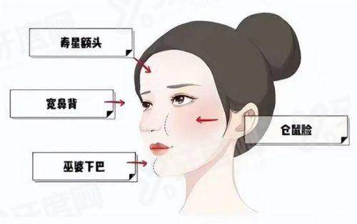 看轻薄针能消除馒化脸吗？溶解再生重塑自然，价格 2000 元起透明合理