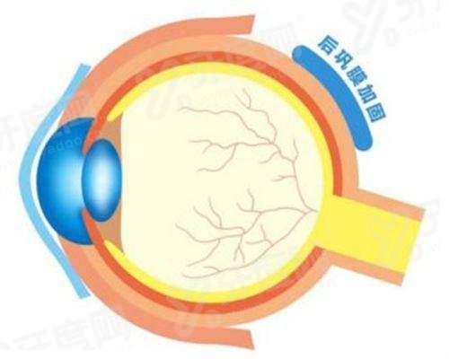 商丘普明眼科口碑评价怎么样？资深专家亲诊技术精湛，患者真实反馈视力恢复清晰自然