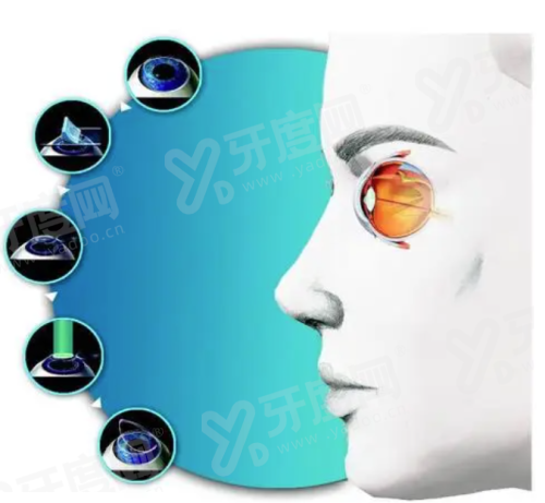 二、石家庄爱眼眼科医院的医生技术靠谱吗？yanke.yadoo.cn