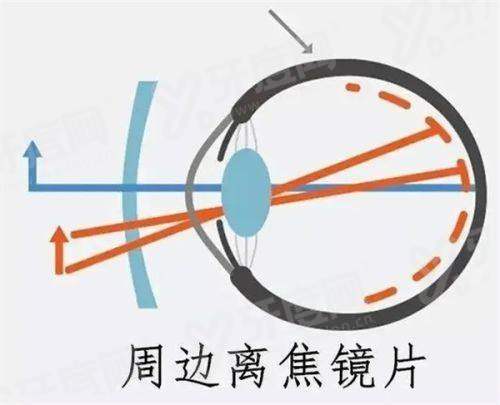 三、想找商丘普明眼科的医生看病，具体怎么预约及费用多少？yanke.yadoo.cn