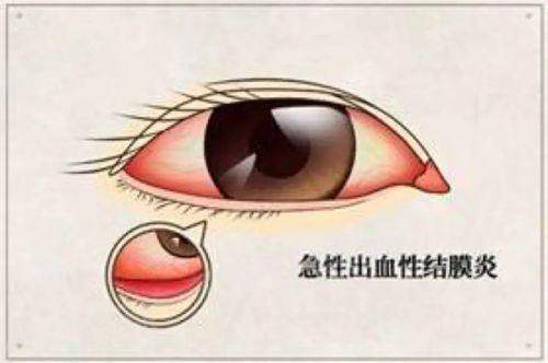 三、在石家庄爱眼眼科医院怎么预约及费用详情？yanke.yadoo.cn