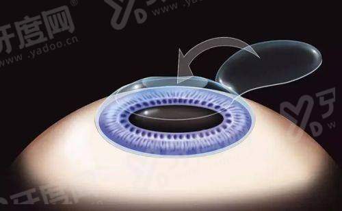 湖南长沙裕湘医院是公立还是私立？正规资质医生技术精湛塑美自然更安心