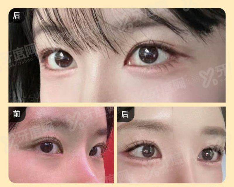 杭州格莱美医疗美容医院预约挂号；医生团队技术精湛项目多样效果自然满意度高服务贴心