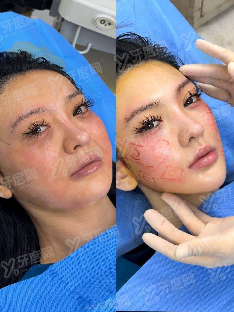 二、如何预约杭州格莱美医疗美容医院？yanke.yadoo.cn