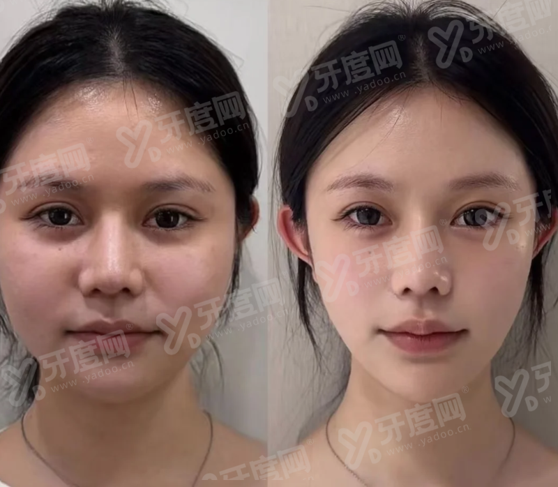 二、杭州格莱美医疗美容医院怎么样？值得信赖的高品质医美机构yanke.yadoo.cn