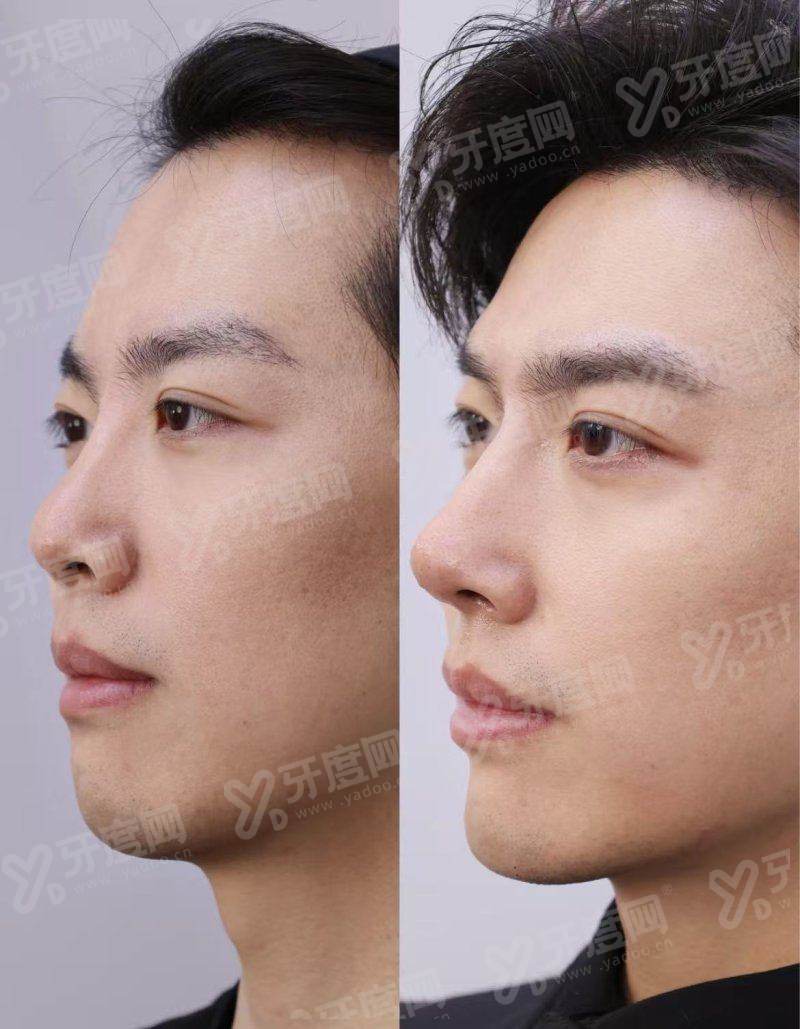 杭州格莱美医疗美容医院院长是谁？技术精湛专注面部年轻化效果自然备受好评