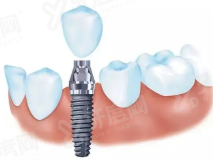 三、乌鲁木齐双宝口腔价格表及服务细节yanke.yadoo.cn