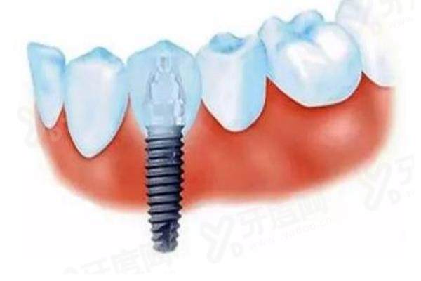 盘锦铭松博爱口腔是私立的吗？是的微创技术好，口碑评价高，收费透明