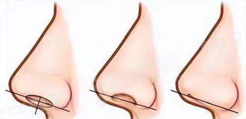 湖南常德美莱整形医院电话是多少？专业团队打造自然灵动鼻部整形；湖南常德美莱整形医院电话咨询，20年经验医生为您定制美丽方案；湖南常德美莱整形医院电话服务，特色项