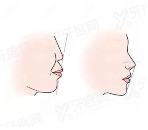 二、杭州越城牙科医院预约挂号yanke.yadoo.cn