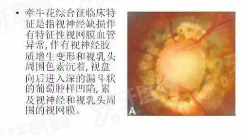 二、贵州爱尔眼科收费透明吗yanke.yadoo.cn