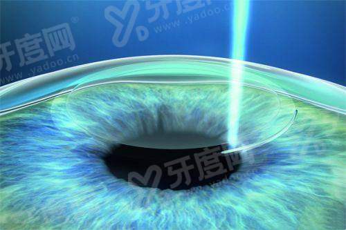 二、两位医生的手术方案有何不同侧重？yanke.yadoo.cn