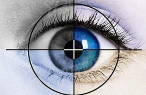 广州爱尔眼科医院可靠吗？可靠/专家团队加持，万千成功案例