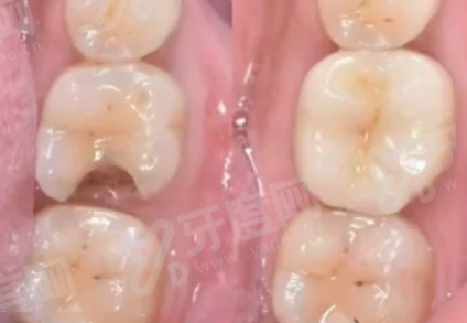 三、库尔勒美康口腔医院价格表？（价格公开透明，多种项目满足需求）yanke.yadoo.cn