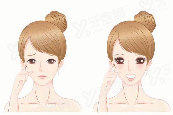 纳米无痕双眼皮和埋线双眼皮的区别是什么？适用人群、恢复周期、效果维持时间大揭秘！