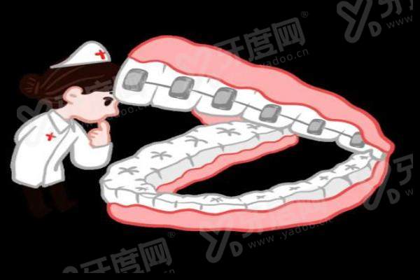 运城美瑞臣口腔李亮和张雯种植牙哪个好？李亮擅长即刻种植，张雯精于美学修复技术更靠谱