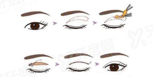 常德美莱整形医院口碑如何？技术精湛医生团队强，特色项目效果自然满意高