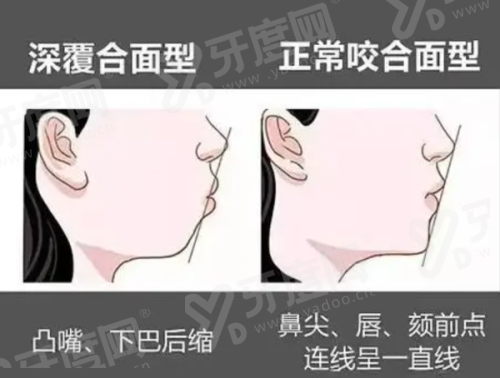 二、美国皓圣属于什么档次？中高端档次质量好yanke.yadoo.cn