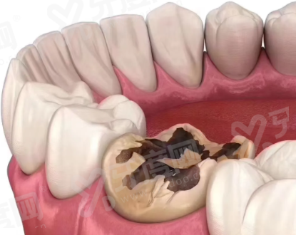 二、兰州牙齿美容修复哪里靠谱yanke.yadoo.cn