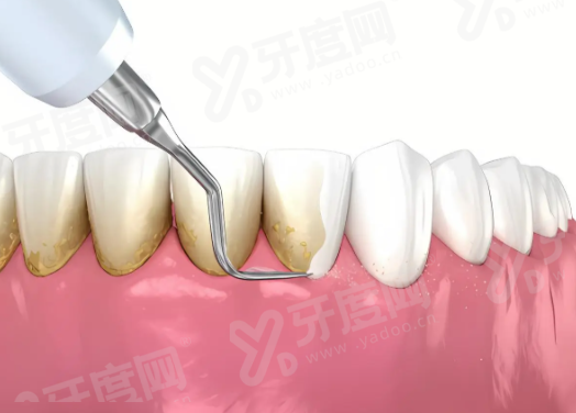 兰州海涛口腔医院靠谱：数字化种植技术强且收费透明，正规连锁口碑好值得信赖