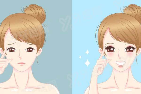 贾亮医生修复双眼皮怎么样？修复技术精细自然灵动，双眼皮实例+价格