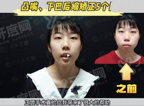 二、广州紫馨整形外科医院口碑怎么样？（真实实例分享）yanke.yadoo.cn