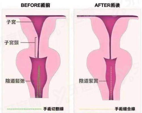 三、济州岛 nowmedi 皮肤科价格表yanke.yadoo.cn