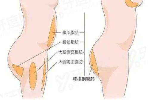 深圳伽美贝拉医疗美容门诊部是正规的吗？院内主打微创抗衰技术效果自然收费透明