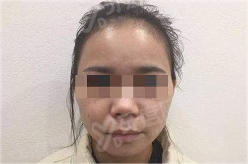 一、广州紫馨整形外科医院预约挂号？（多种便捷方式任你选）yanke.yadoo.cn