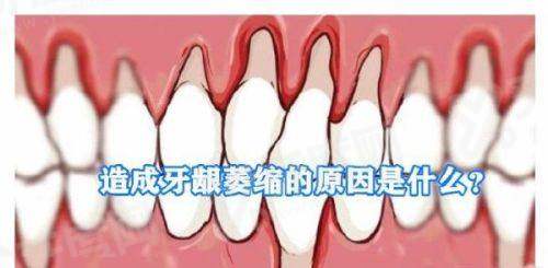 东莞牙状元口腔医院是公立还是私立？属正规私立机构，硕博团队领衔数字化种植矫正价格透明