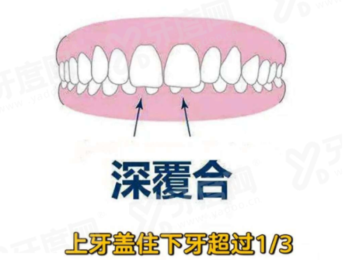 北京海淀中诺口腔医院种植牙靠谱吗？资深院长亲诊技术稳价格透明口碑佳