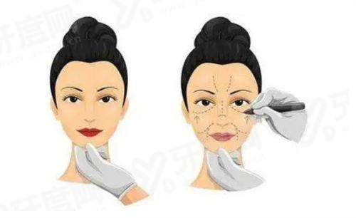 三、贾亮医生修复双眼皮多少钱？yanke.yadoo.cn