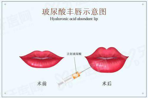 二、天津申伊童颜医疗美容诊所口碑怎么样？真实实例见证成效