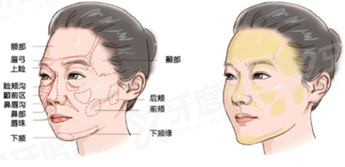 广州紫馨整形外科医院收费标准？双眼皮 3980 元起，真实口碑好价格透明放心选！