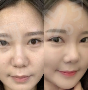 二、上海美立方医疗美容医院怎么样yanke.yadoo.cn