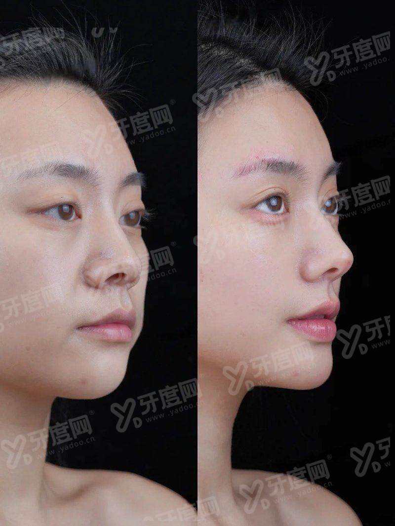 上海美立方医疗美容医院怎么样？医生技术精湛价格实惠，地址在静安区汉中路