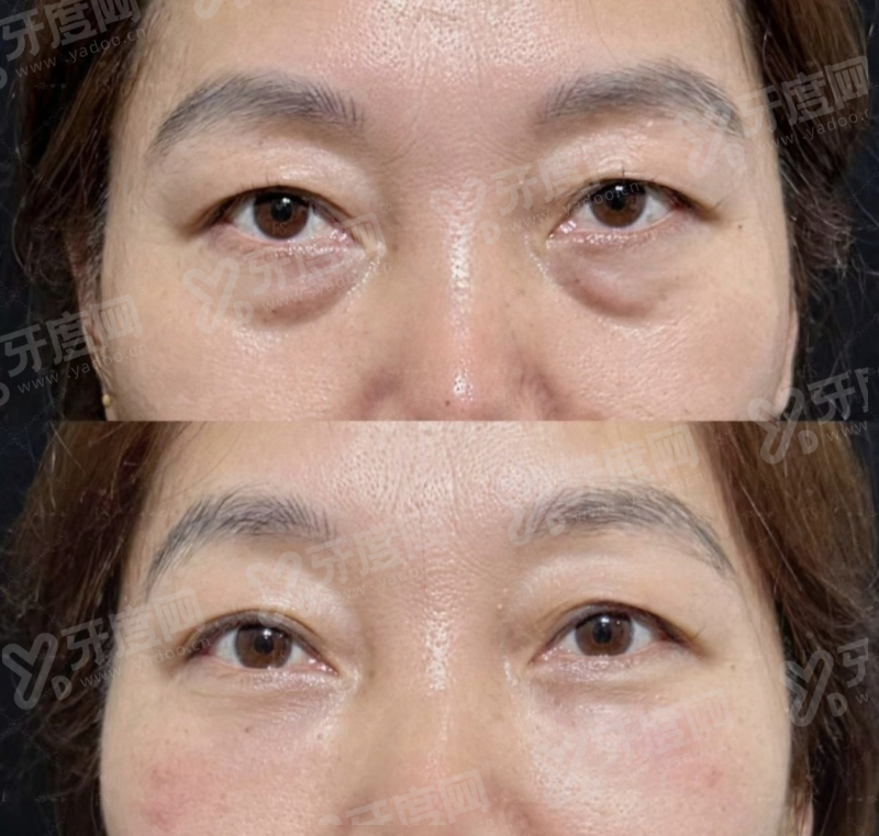 天津申伊童颜医疗美容诊所是正规的吗？专注抗衰技术，医生团队经验丰富效果自然