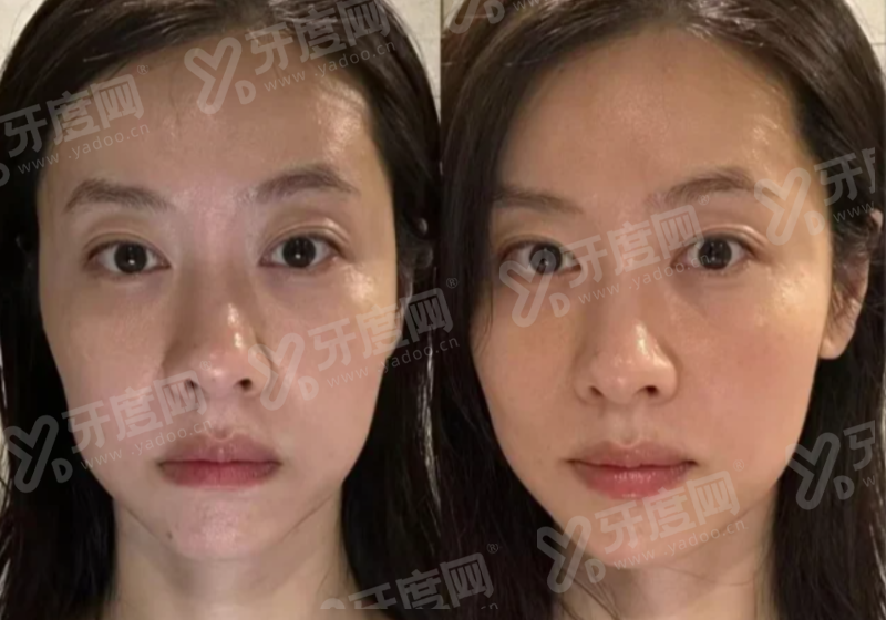 济州岛 nowmedi 皮肤科地址在哪里？在济州市莲洞，真实反馈显示效果自然值得面诊