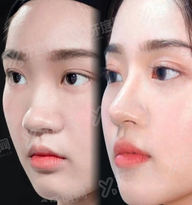 广州紫馨整形外科医院是正规吗？正规，拥有专业医生团队技术先进设备完善值得信赖