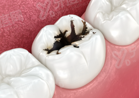 三、平湖看牙怎么预约更省心yanke.yadoo.cn