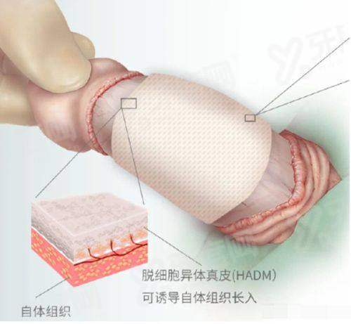 二、濟州島 thelift 皮膚科挂号攻略yanke.yadoo.cn