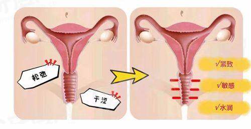 二、乔爱军的脂肪修复怎么样？yanke.yadoo.cn