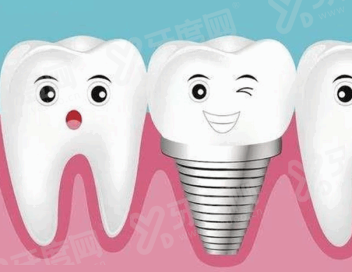 重庆瑞泰口腔医院怎么样？种牙矫正技术好价格透明地址便利