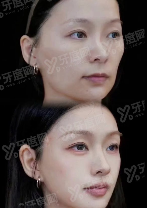 2026濟州島 thelift 皮膚科价格表：水光800+光电1.2W起