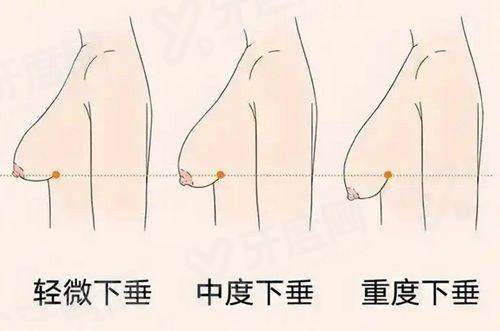 佛山曙光金子医学美容医院收费贵吗？不贵！热玛吉价格透明，效果自然让你变美更安心！