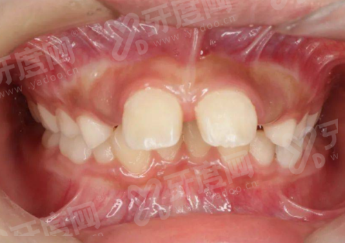 三、合肥中诺口腔医院预约挂号方式与地址